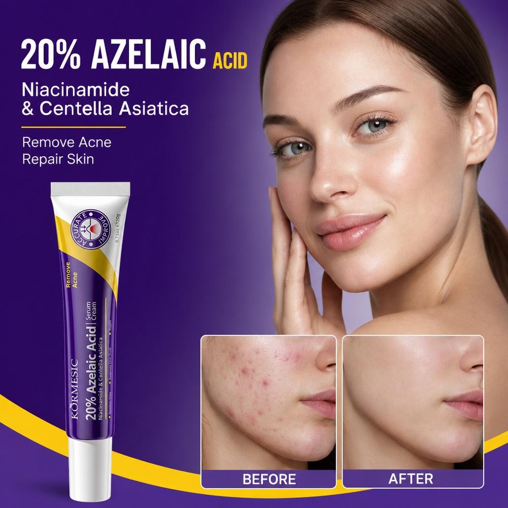 Esencia de Ácido Azelaico al 2 - Luxury Skincare Brands reseña y precio